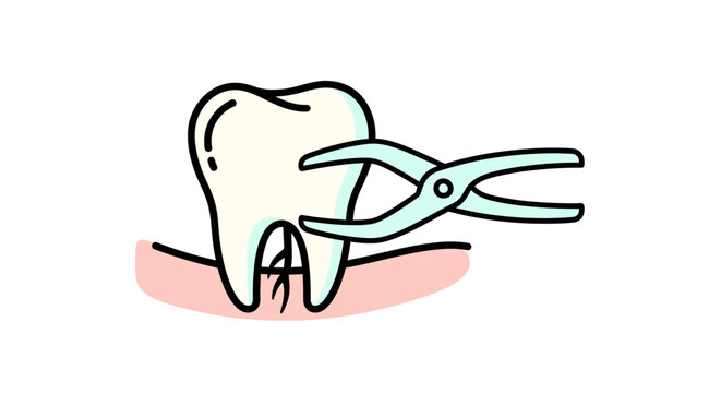 Dental extraction with forceps illustration.
