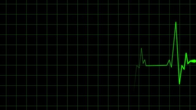 Dynamic cardiograph recording displaying a vibrant green heartbeat on a black grid monitor, symbolizing vital signs and medical health data monitoring