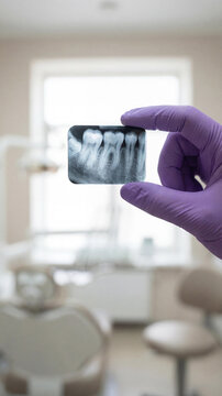 Dentist hand in a purple glove holding a dental X-ray film showing teeth roots in a blurred clinic background. Stomatology diagnosis and healthcare concept.