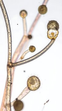 Microscopic view of fungal hyphae structure.