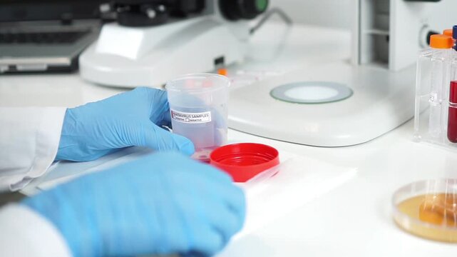 Hands in blue gloves using a plastic pipette to transfer a red liquid sample from a container onto a glass slide for medical testing.