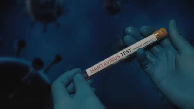 Medical laboratory hantavirus test with virus cells and blue gloves