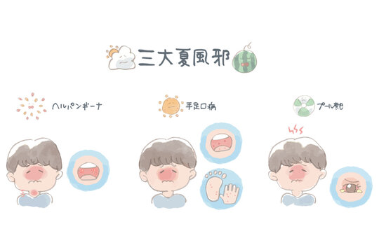 三大夏風邪 イラストセット 手書き文字 ヘルパンギーナ 手足口病 プール熱 水彩 感染症予防