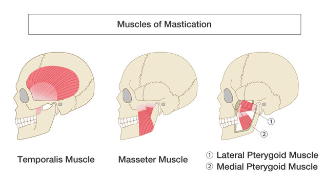 Anatomical illustration set of the skull and muscles of mastication (temporalis, masseter, lateral pterygoid, and medial pterygoid) viewed from the side