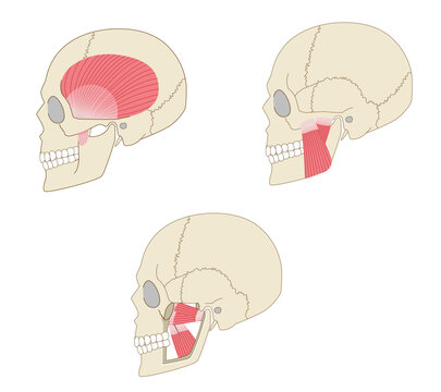 Anatomical illustration set of the skull and muscles of mastication (temporalis, masseter, lateral pterygoid, and medial pterygoid) viewed from the side
