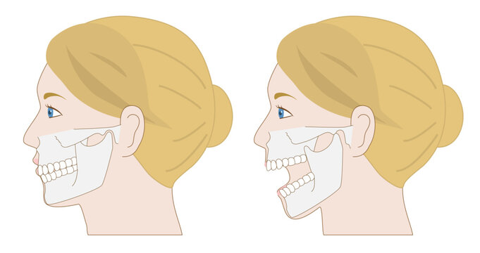 Set of anatomical illustrations of a White woman&rsquo;s profile with the jaw closed and open