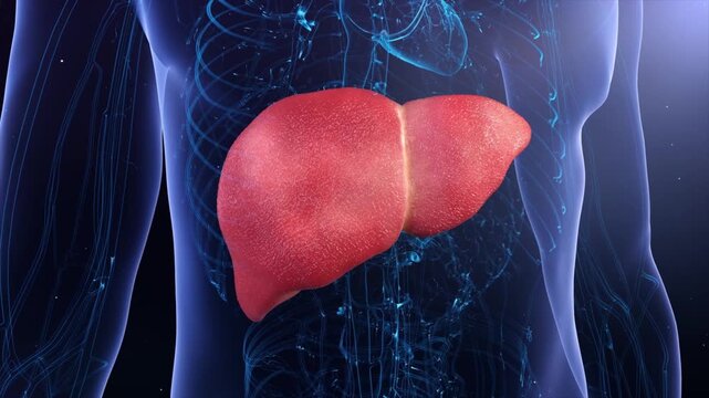 3D animation depicting liver cirrhosis, hepatitis, fibrosis, malignancy, and viral infection leading to hepatocellular carcinoma and liver failure. Digestive system deterioration.