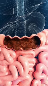 4K alpha channel 3D: stool retention in rectum, slow peristalsis, toxin accumulation. Leads to enteritis, digestive disorders, and intestinal dysfunction.