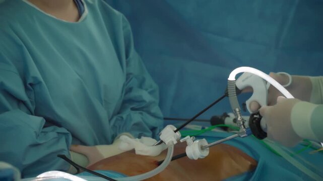 Laparoscopic cholecystectomy instrument. The surgeon's doing laparoscopic gastric sleeve surgery