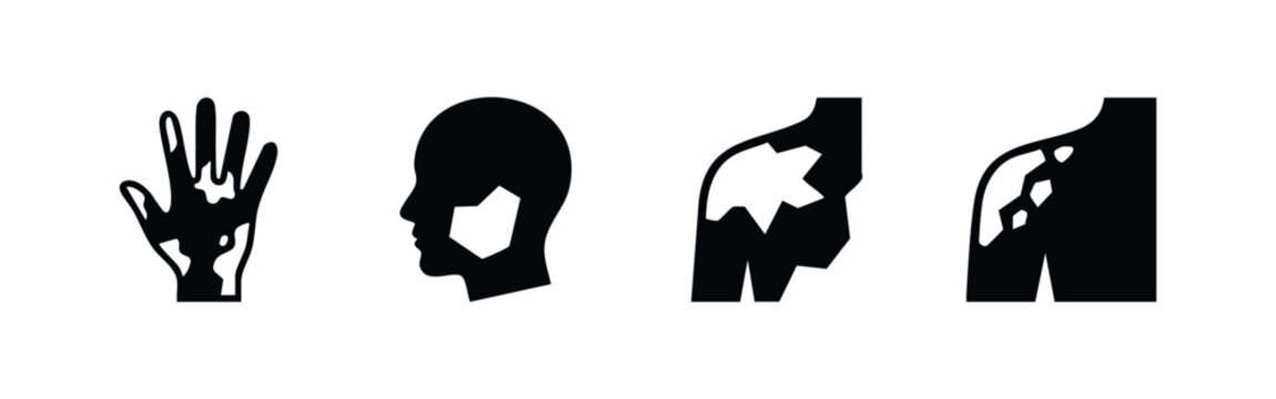 Vitiligo Skin Depigmentation Condition Icons