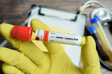 Obraz premium Leukemia and lymphoma panel Test with blood sample in yellow gloved hands.