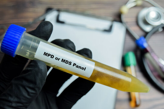 Myelodysplastic and Myeloproliferative Disorders Test with blood sample in black gloved hands.