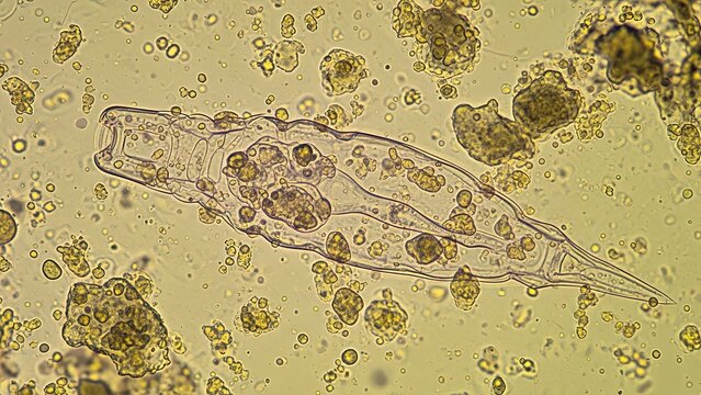 Microscopic rotifer under examination, a fascinating realm of tiny aquatic inhabitants in stunning