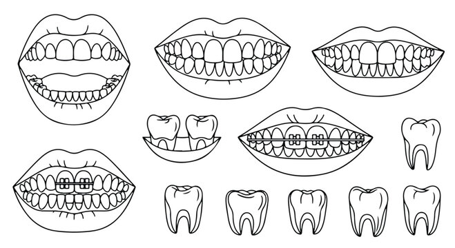 Set of line drawings illustrating various aspects of human teeth and mouths, including dental conditions and oral hygiene tools, black and white