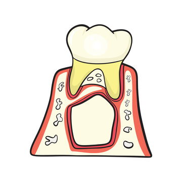 Primary Dentition Illustration 
