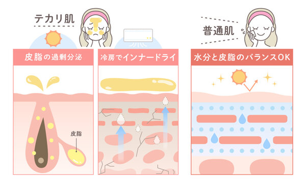テカリ肌と普通肌の比較図解｜皮脂・インナードライ・肌バランスの美容ベクター素材