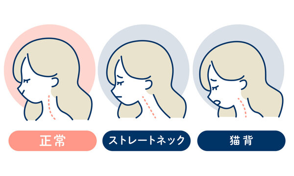 正常な姿勢・ストレートネック・猫背の比較図解｜首の角度と姿勢の違いがわかる健康ベクター素材