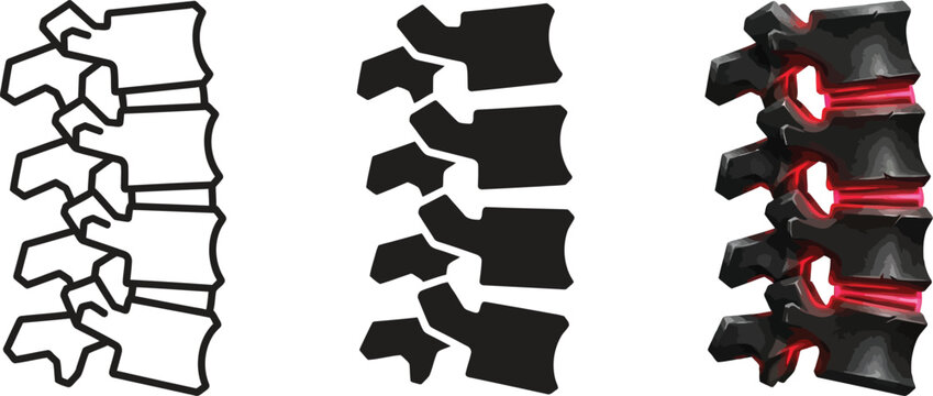 Anatomical illustration of the human spine depicting healthy and inflamed intervertebral discs for medical education and back pain awareness