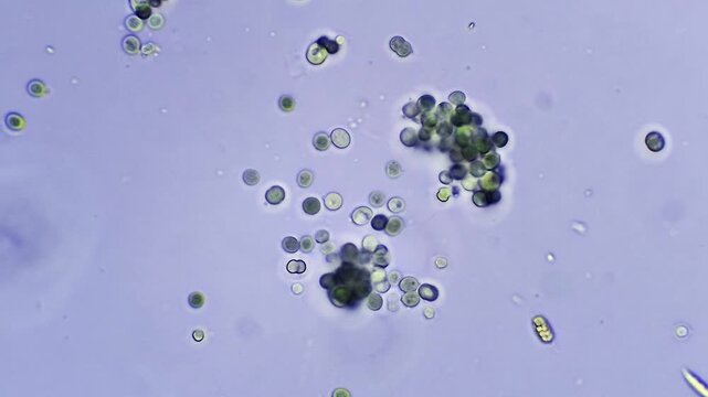 Algae - Micro organism at microscope magnification