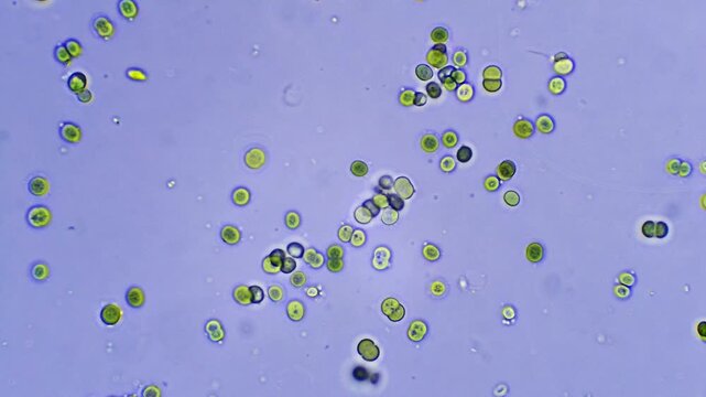 Algae - Micro organism at microscope magnification