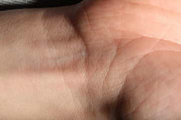 Naklejka premium Texture of normal skin as background, closeup
