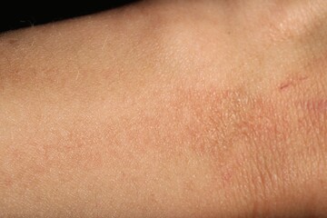 Fototapeta premium Texture of normal skin as background, closeup