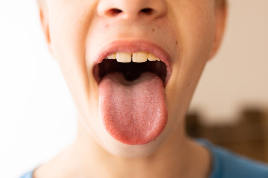 Child sticking tongue out. Boy showing his tongue for health check. Medical examination of throat and oral cavity. Pediatric checkup for dental and oral hygiene in clinic environment.