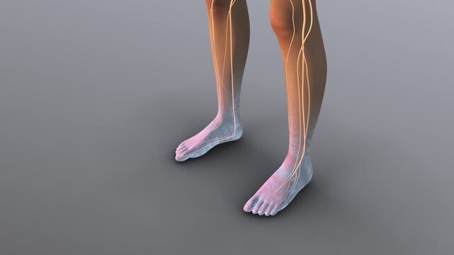 Peripheral Nerve Numbness in Lower Limbs