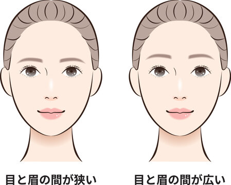 目と眉の間（狭い・広い）比較イラスト