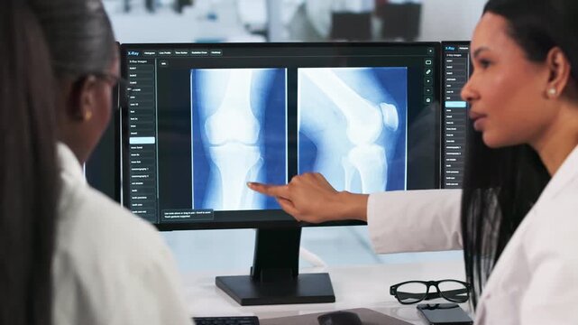 Orthopedic Doctors Reviewing Knee X-ray Scans
