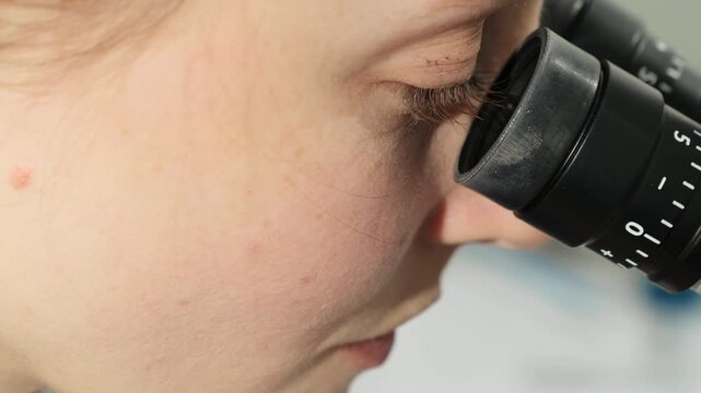 Gynecologist examines Pap test sample through microscope in close view. Specialist studies specimen carefully checking optical focus during review