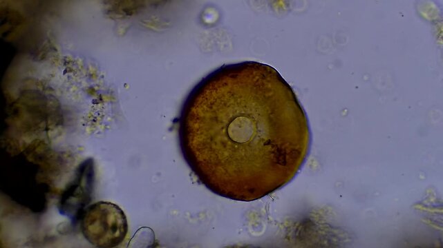 Diatom - Micro organism at microscope magnification