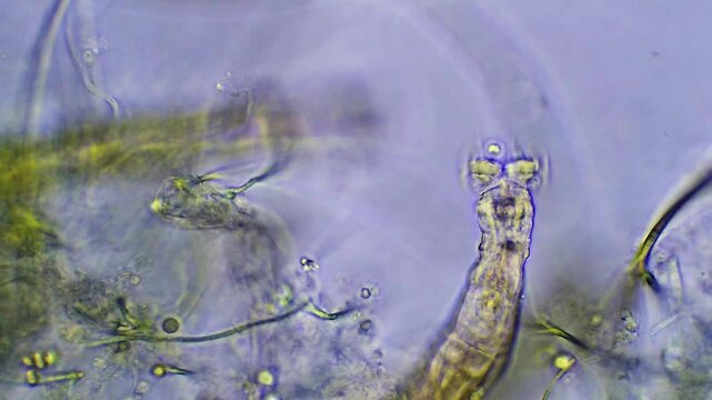 Rotifer - Micro organism at microscope magnification