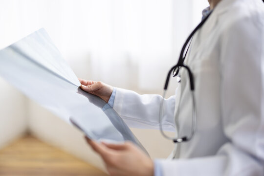 Close-up of Hands of Asian Female Doctor Reviewing X-ray Image