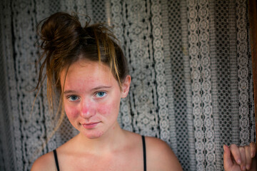 Fototapeta premium Portrait of teenage girl with freckles and blue eyes standing by lace curtain in soft window light indoors.