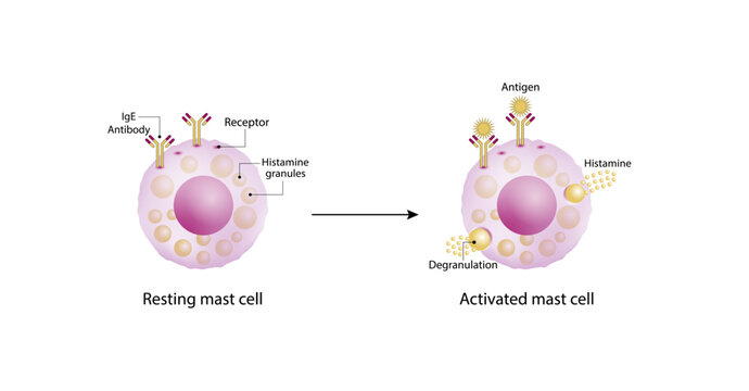 Resting and activated mast cell. Anaphylactic, allergic reaction, Autoimmune disorders, allergy and anaphylaxis. IgE antibodies are in involved in Anaphylactic reaction. Vector illustration.