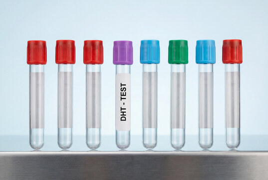 Row of blood sample tubes with purple capped DHT test tube in laboratory