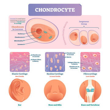 Chondrocyte illustration infographic, transparent background. Medical labeled scheme structure of chondrocyte in lacunae, interterritorial matrix, elastic, hyaline and fibro cartilage.