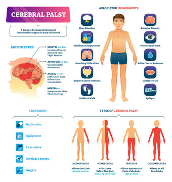 Cerebral palsy illustration, transparent background. Labeled permanent movement disorder type scheme. Medical educational diagram with motor types, associated impairments and treatment.
