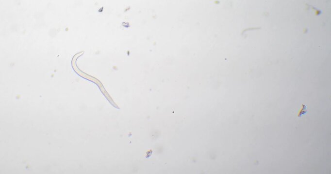 Parasitic nematode worm moving under a microscope