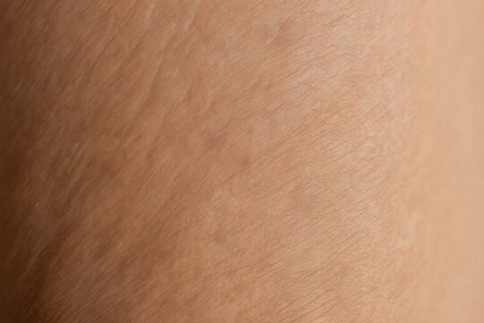 Close up detail of human skin texture shows fine lines and pores. Natural beige flesh tone provides neutral background. Shows surface of arms or legs.