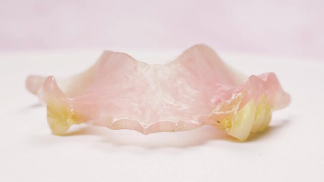 Footage of rotating upper partial denture. Removable dental prosthesis dentistry oral healthcare prosthodontics dental treatment medical education dental clinic presentations tooth replacement.