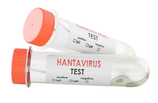 Two hantavirus test specimen tubes, 3D Rendering