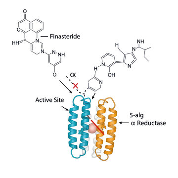 Finasteride Blocks 5-alpha Reductase Active Site