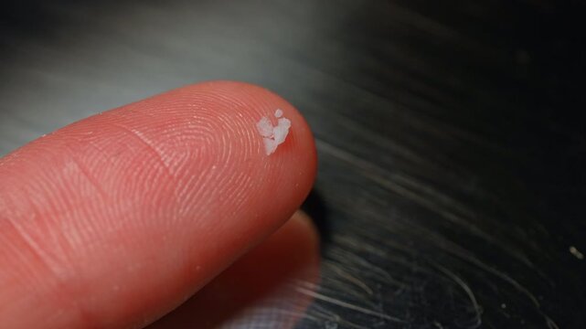 Person display two milligrams fentanyl on the finger skin concept lethal dose for people in most cases. Educational concept of street fentanyl drug can be injected snorted sniffed smoked, taken orally