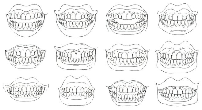 Collection of detailed human dental anatomy diagrams showing various arrangements of upper and lower teeth sets for educational and medical purposes