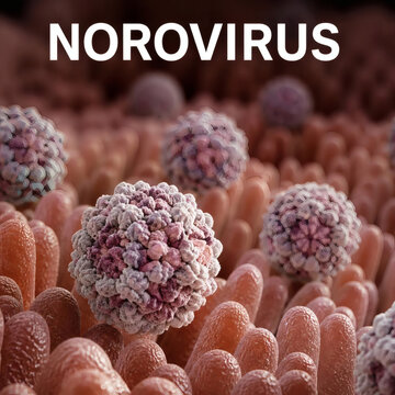 norovirus in human intestine winter vomiting bug microscopic view rna caliciviridae virus gastroenterology pathogen medical with bold white text on warm neutral background