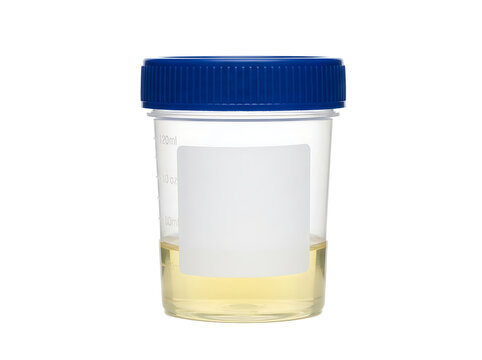 Medical urine specimen cup with transparent background for lab analysis.