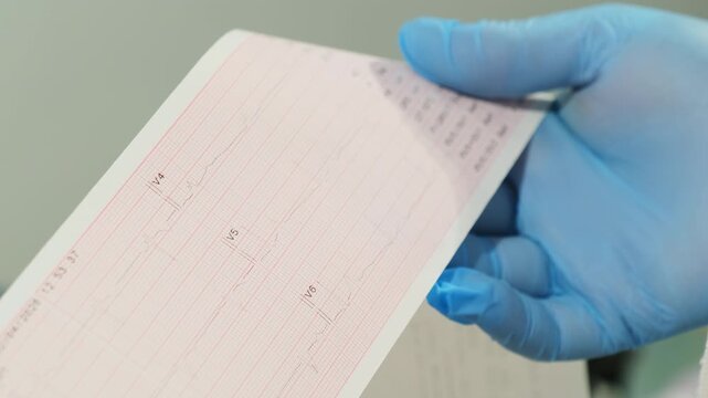 Doctor studies diagnostic paper strip with recorded test lines. Medical worker holds result sheet reviewing printed data after examination