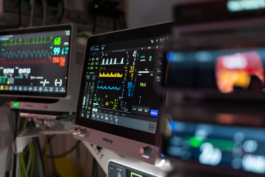 Pacient in the operating room. High-tech Mindray patient monitors in a clinical operating room displaying real-time vital signs, heart waveforms, and oxygen saturation parameters.